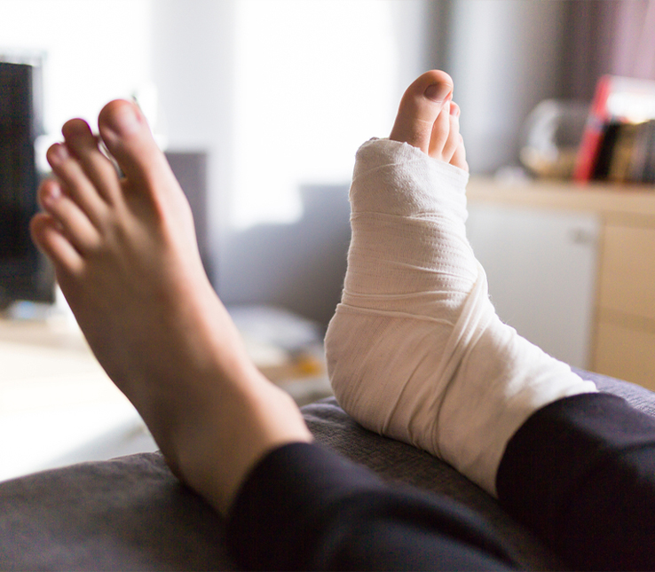 Foot & Ankle Fractures