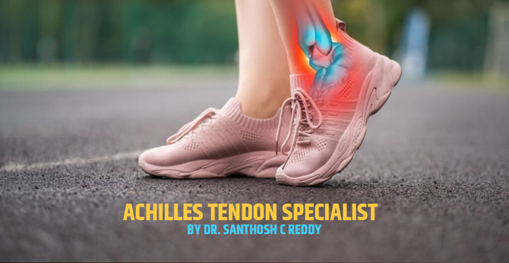 Dr. Santhosh C Reddy Achilles Tendon Specialist in Bangalore