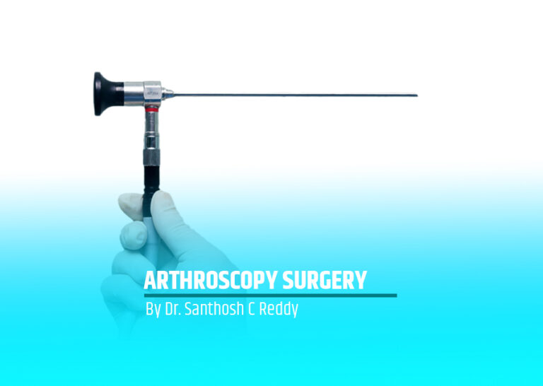 Arthroscopy Surgery by Dr. Santhosh C Reddy