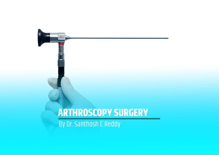 Arthroscopy Surgery by Dr. Santhosh C Reddy