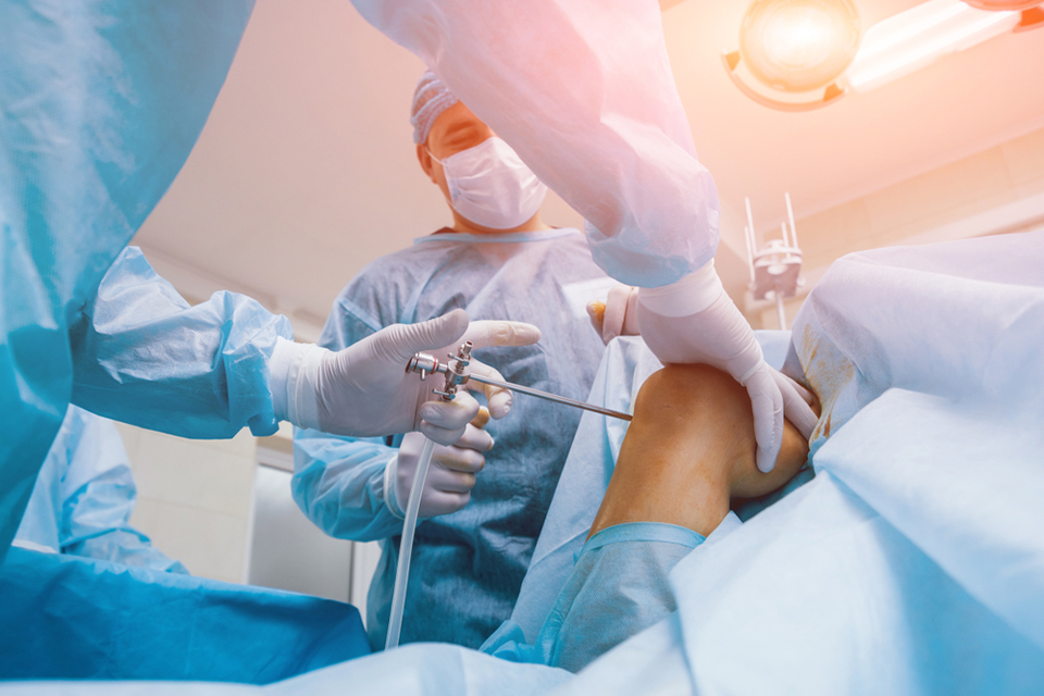 Arthroscopy Surgery