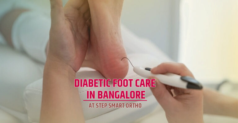 Diabetic Foot Care in Bangalore