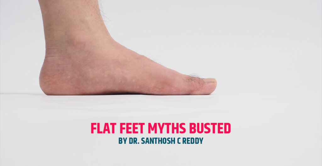 Feet Myths Busted by Dr. Santhosh C Reddy