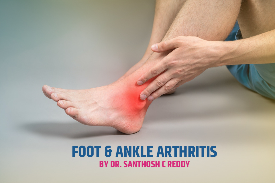 Foot & Ankle Arthritis Early Warning Signs